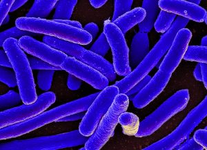 E_Coli1