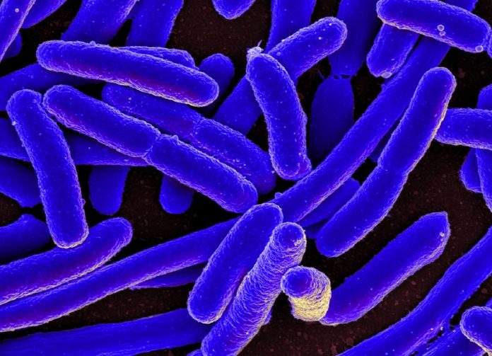 E_Coli E_Coli1