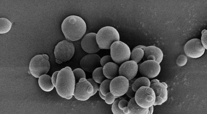 Biologie moleculară: drojdie rezistentă evidențiată prin metoda Lamp Kazachstania barnettii